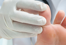 How to Heal a Toe Infection Safely