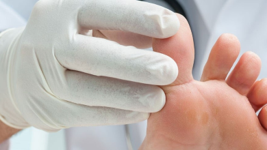 How to Heal a Toe Infection Safely