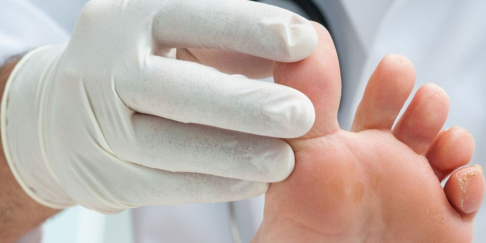 How to Heal a Toe Infection Safely