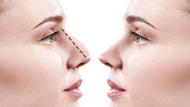 Top Reasons To Consult a Rhinoplasty Doctor Near Washington DC